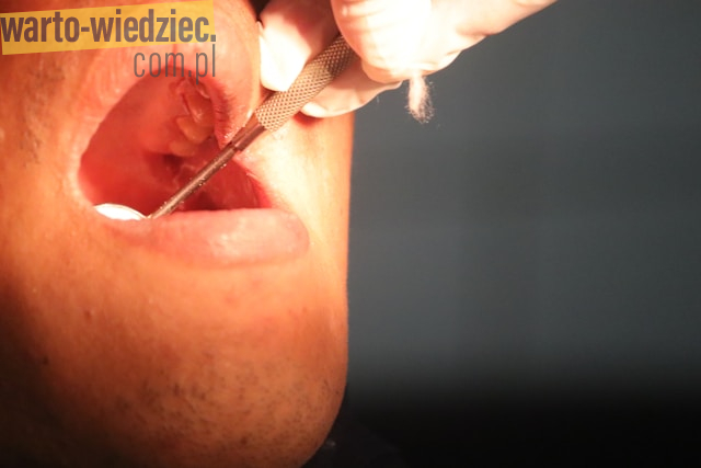 Wpływ kosmetyków na stan zdrowia błon śluzowych jamy ustnej: kluczowe korzyści